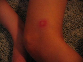Ca-chee's knee